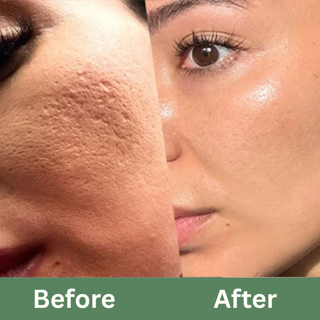 Skin Detox Set