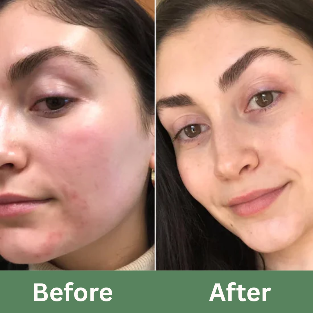 Skin Detox Set