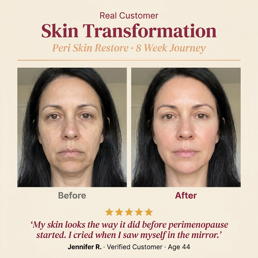 Peri Skin Restore